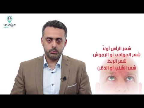 اكتر موضوع بيشغل مرضي السرطان هو الشعر هيقع ولا لا ! | د/ احمد عبد الهادي