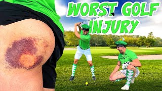Creating the WORST GOLF BALL INJURY of all Time *SEVERE DAMAGE*