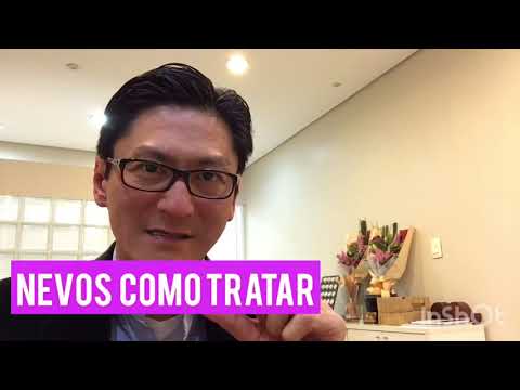 Vídeo: Nevus: O Que é, Fotos, Tipos, Como Tratar, Causas Do Aparecimento