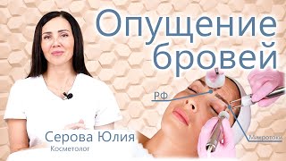 🔬Опущение бровей. Подтяжка, лифтинг и коррекция бровей. 🙌 Исправляет косметолог Серова Юлия 🐱‍🏍