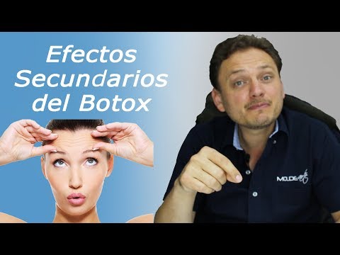 What are the side effects of Botox?