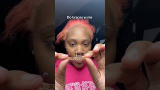 Have you ever seen fake braces before ? meet me in the comments 🤷🏽‍♀️#explorer #braces #fyp
