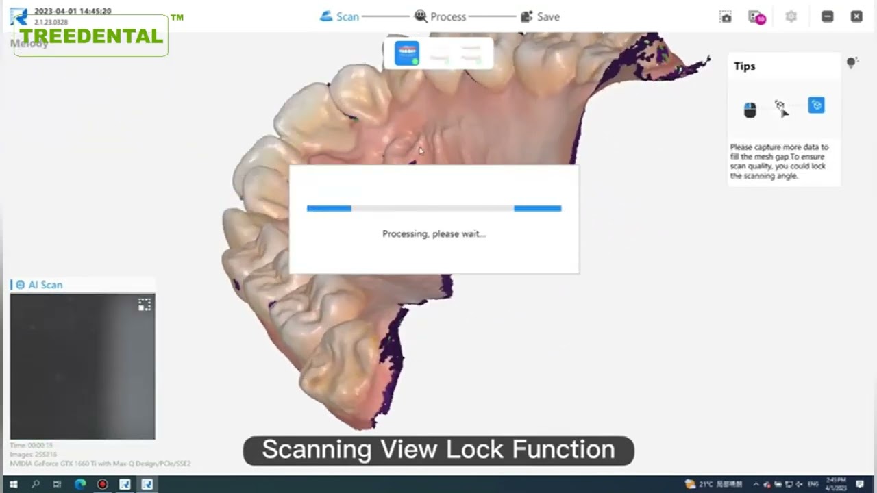 CE&FDA Approved Intraoral Oral Trade Handheld Digital Dental 3D Intraoral Scanner With Software