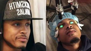 august alsina keratoconus eye disease