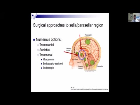 Pituitary Tumors: What You Need to Know about Surgery Webinar