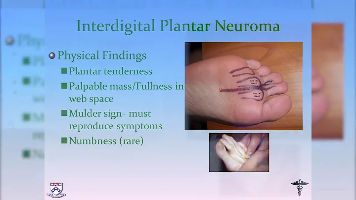 Dr. Timothy Epting, Foot Pain - Florida Orthopaedi...