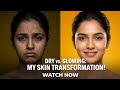 Dry Skin Care Routine(Hindi) 100% Working Tips for Glowing Skin #skincare #dryskintreatment #dryskin