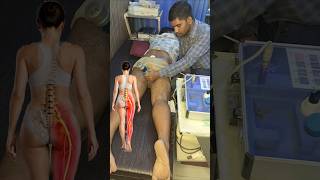 Sciatica Pain Treatment | Shockwave Therapy + Cupping Therapy + Spinal Decompression | Chiropractic