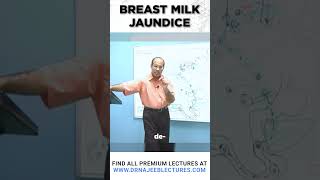Breast Milk Jaundice #drnajeeb #jaundice #shortvideo