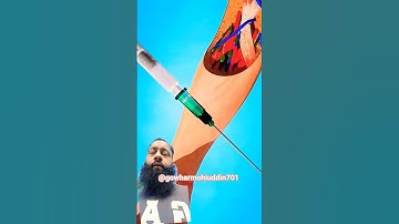 Mistake That Can cause internal Bleeding 😱🤔 #shorts #viralshort