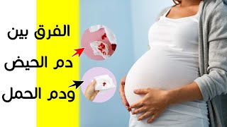 الفرق بين دم الحيض ودم الحمل في البداية | الفرق بين دم الدورة ودم الإجهاض | هل دم الحمل له رائحة