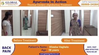 Agnikarma | Treatment for Back Pain, Sciatica, Lumbar Spondylosis | Ayurvedic Treatment