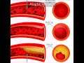Blood Pressure Maxxing Edit | #shorts #maxing #edit #caseoh #alightmotion #fyp #funny #motivation