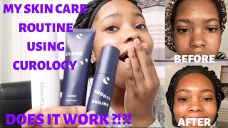 ACNE SKIN CARE ROUTINE 2020 USING CUROLOGY .. DOES IT WORK ?? HONEST REVIEW *NOT SPONSORED*