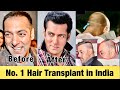 Top Secrets of Salman Khan Hair | सलमान खान के घने बालों का राज़ जानकर चोक़ जाओगे