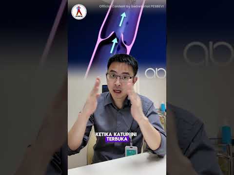 Tanya-tanya Masyarakat Tentang Varises Tanya-tanya Masyarakat Tentang Varises