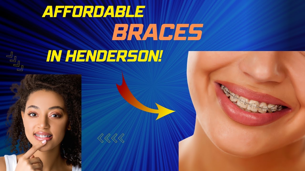 Affordable Braces in Henderson NV l (702) 8257447 l Henderson Free consultation for Cheap