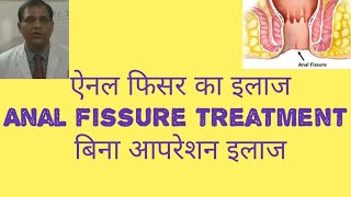 Anal fissure,ऐनल फिशर का कारण वा इलाज।fissure in ano .एनल फिशर का बिना आपरेशन इलाज।मल द्वार मे दर्द।