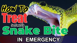 Treatment of Snakebite: Emergency First Aid & How to Identify Poisonous vs. Non-Poisonous Snakes
