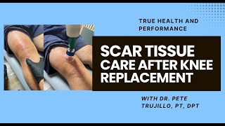 Recover Faster: How Cupping & Scar Massage Help After Knee Replacement Surgery