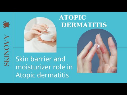 ATOPIC DERMATITIS / ROLE OF SKIN BARRIER IN ATOPIC DERMATITIS - YouTube