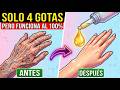 ¿Manchas oscuras en las manos? 1 gota de ESTE aceite DERRITE la melanina rápidamente