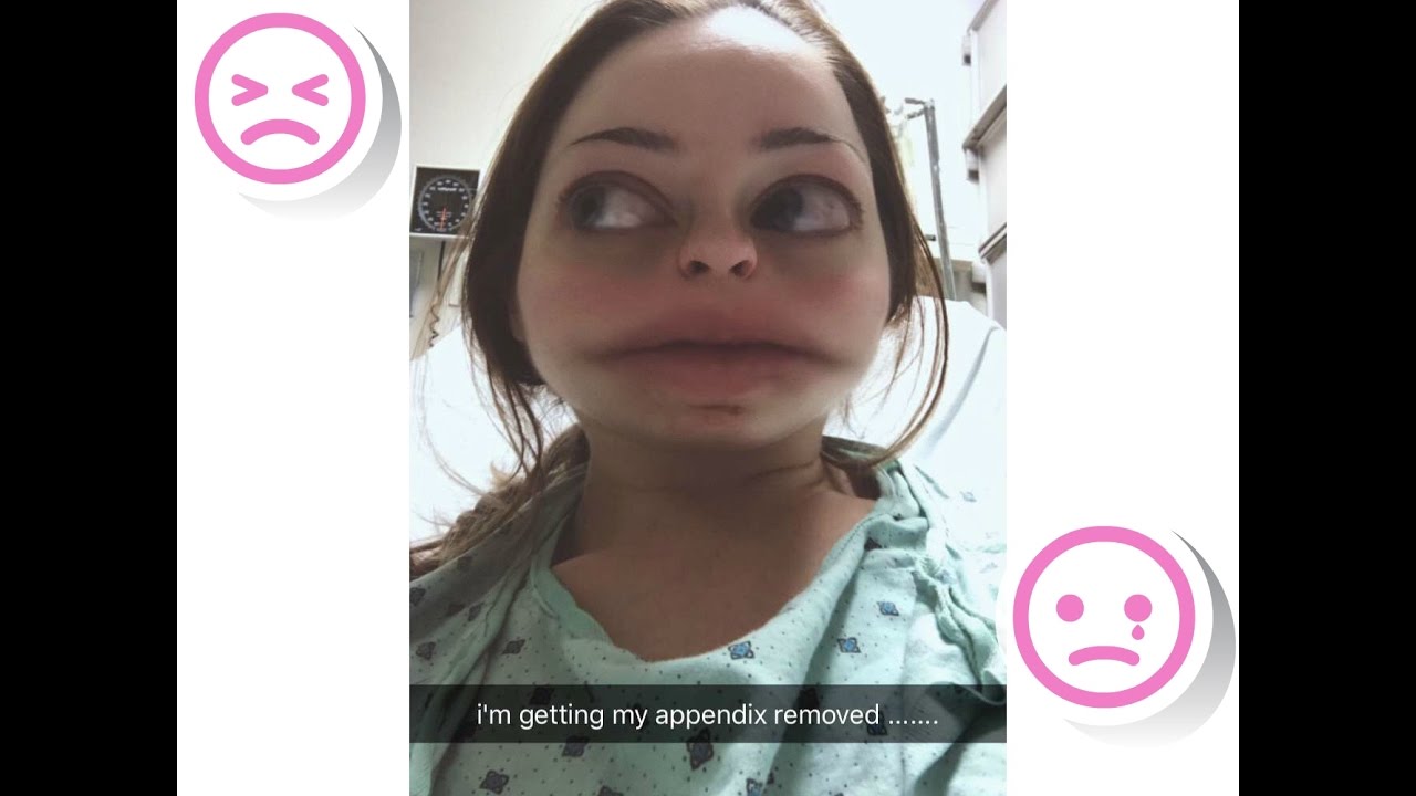 Why Do I Feel Like This My Appendicitis Story Youtube