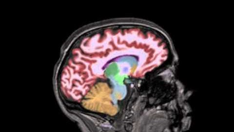 Volumetric images of the entire brain in a sagittal orientation