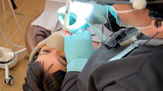 Hygiene Visit With Piezon® LED  Teeth Cleaning (Prophy)  Kate At Perfect Smiles Dentistry