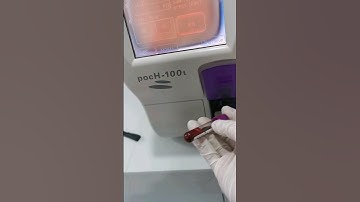 complete blood count CBC #laboratory #mls #cls #medtechstudent #medtech #blood #platelets #diffcount