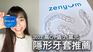Zenyum 隱形牙套矯正過程台灣評價附 1 萬 5 千元折扣碼