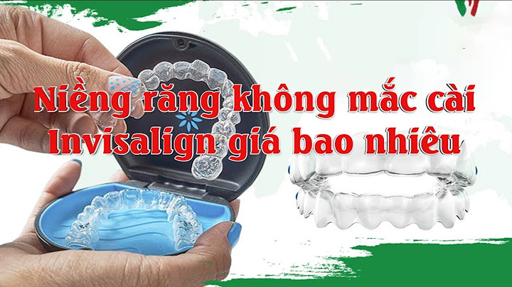 Niềng răng bằng invisalign giá bao nhiêu năm 2024