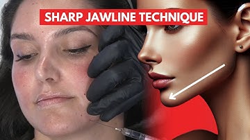 How to achieve a sharp jawline for patients! (It