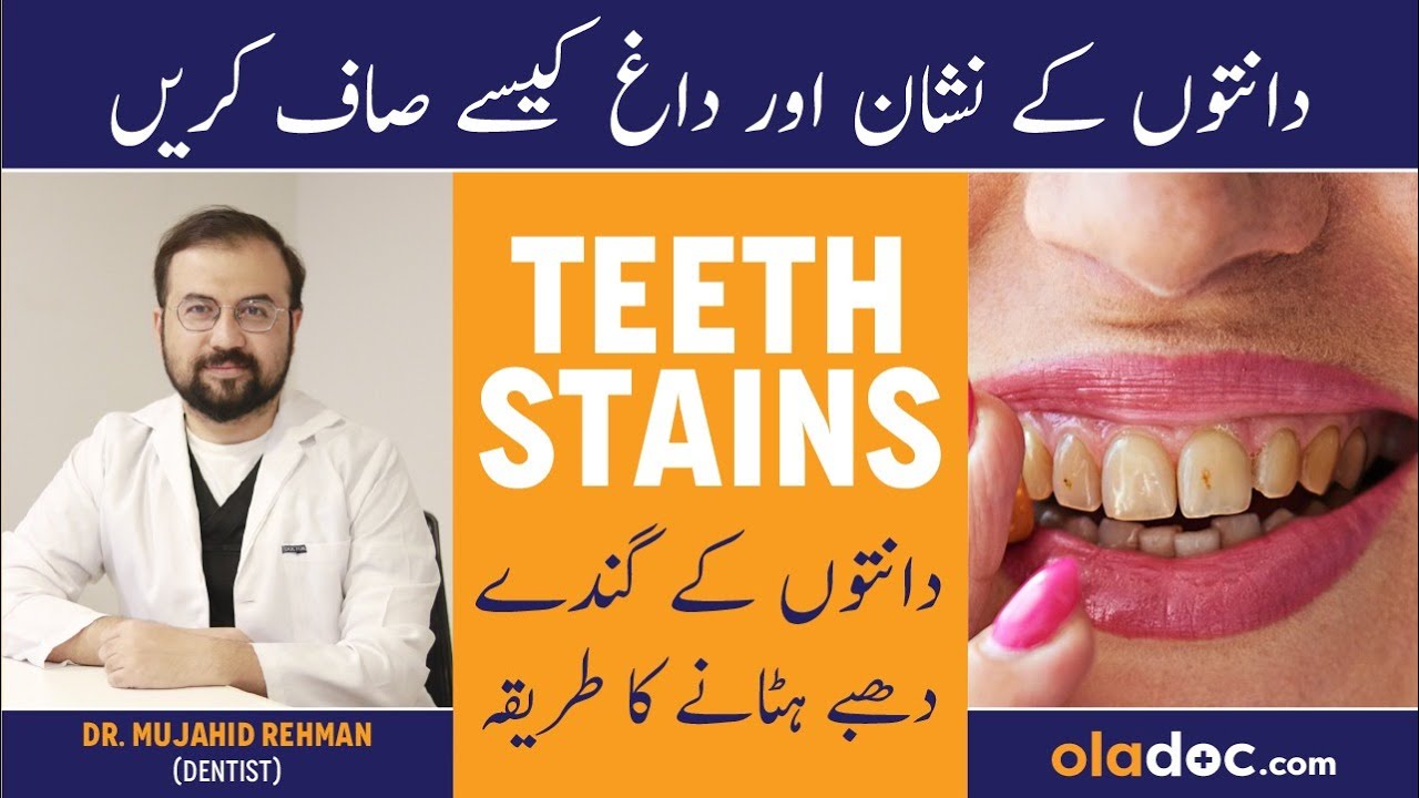 How To Remove Stains From Teeth In Urdu Danto Ke Daag Kaise Mitaye