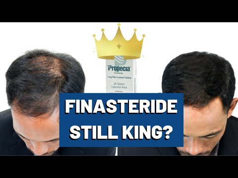 Finasteride for Hair Loss - Is it still KING?
