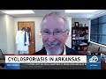 Healthcare providers offer advice on Cyclosporiasis entering Arkansas