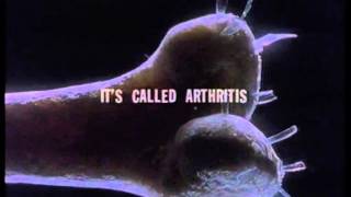 Artritase 1991