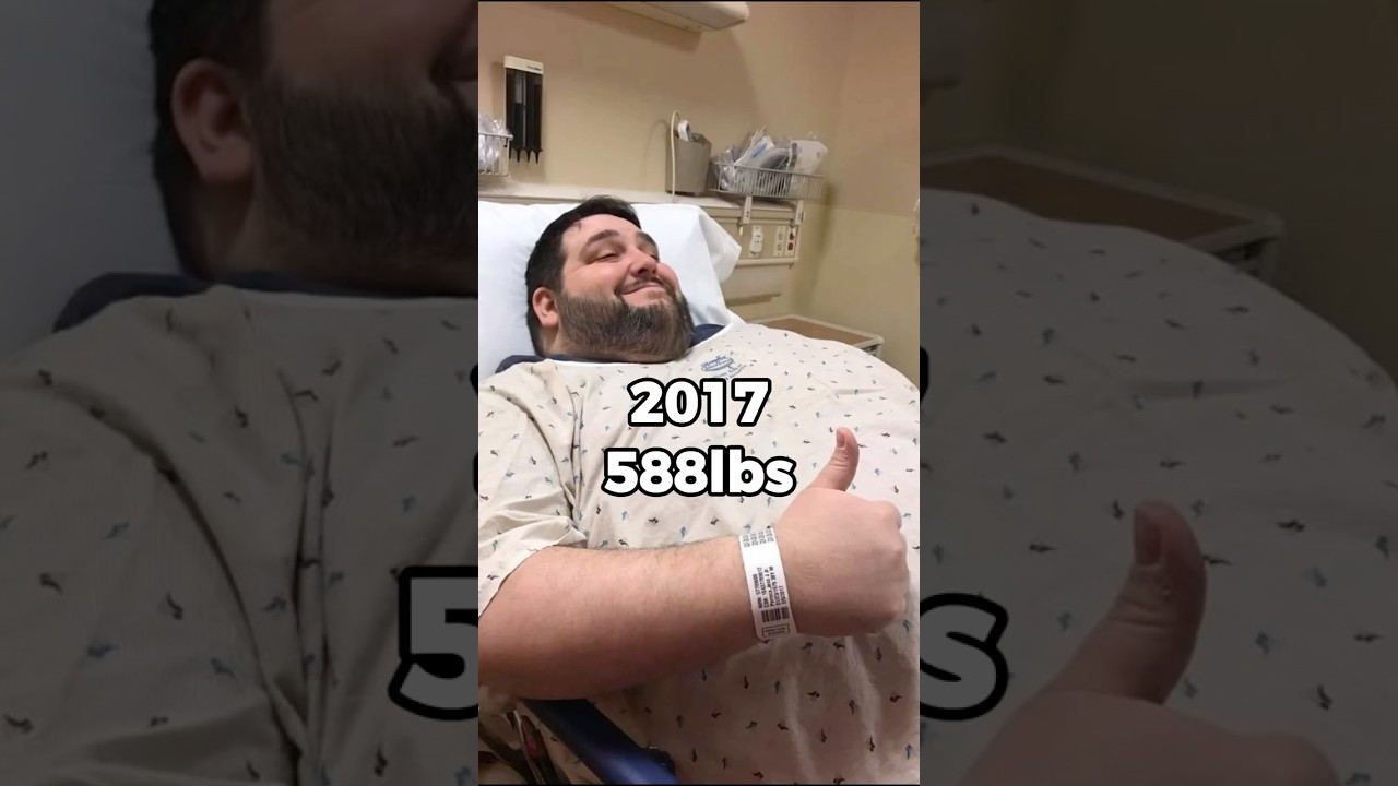 2017: I Thought Surgery Was The End Of My Weight loss Comeback Story