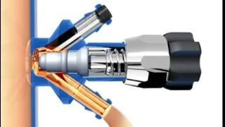 Keofitt M4 Sampling Valve - sampling