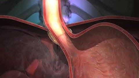 Stretta® Animation Video