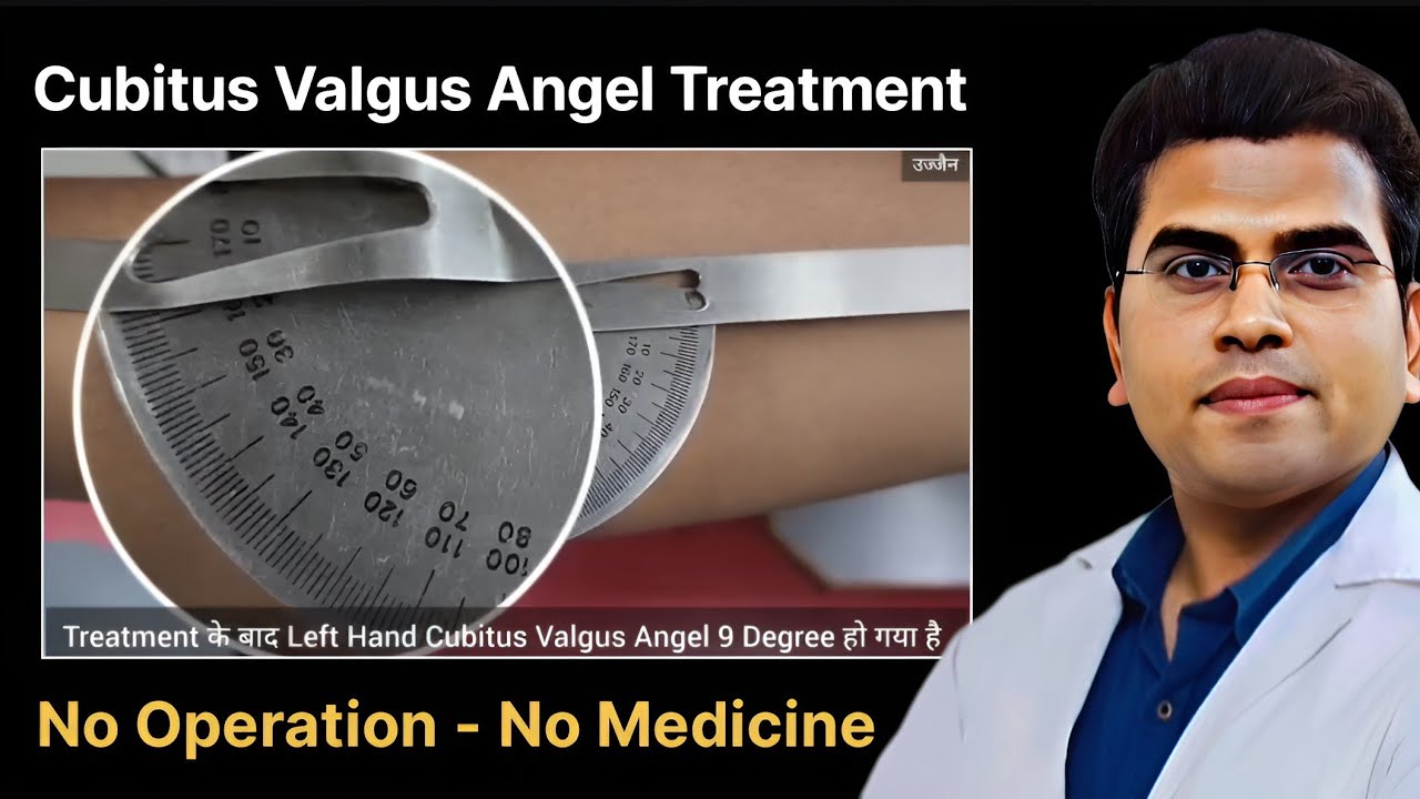 Cubitus Valgus Treatment | Dr Jitendra Jaiswal | Ujjain
