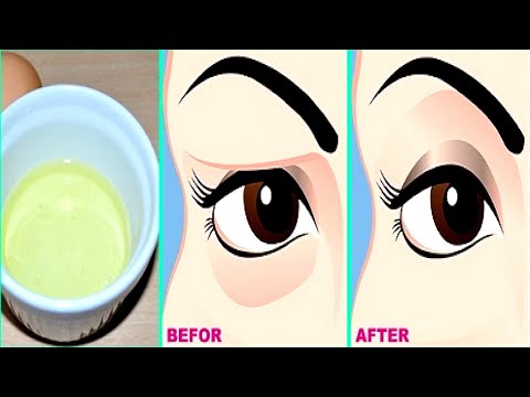 Natural Remedy for Sagging Eyelids You Will See Results In 2 Minutes!!!