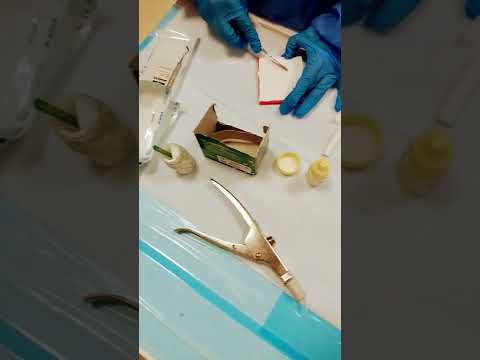    طريقة تصنيع حشوة الاسنان