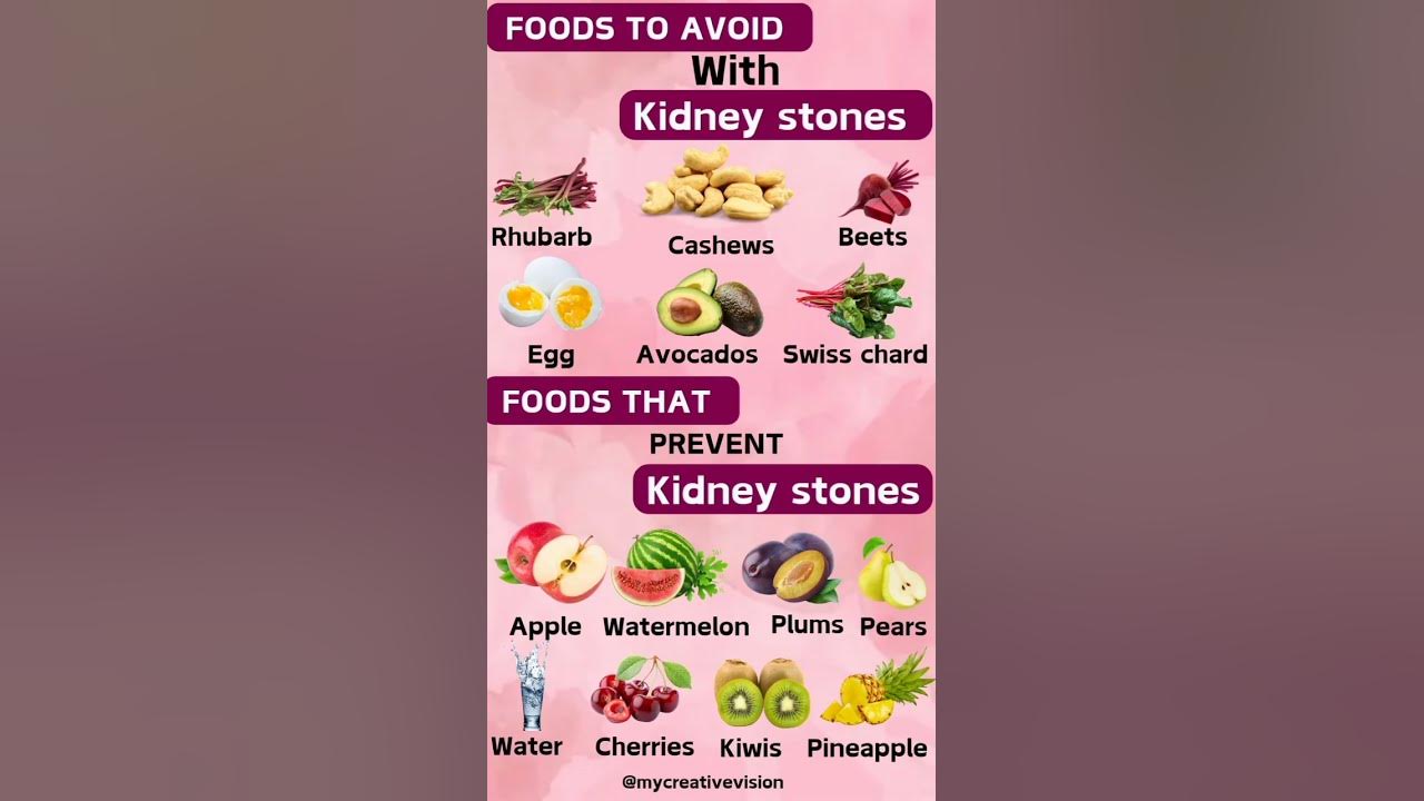 Foods that prevent kidney stones, and some foods to avoid with kidney stones..