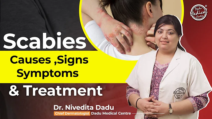 Scabies: Causes, Symptoms & Treatment | How to Treat Itchy Rashes? | Dr. Nivedita Dadu