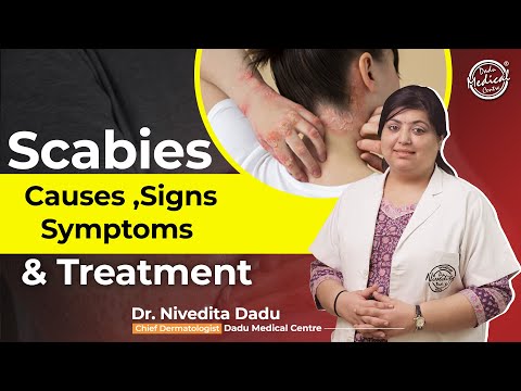 How to Treat Itchy Rashes?