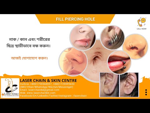 নাক/কান/শারীরিক ছিদ্র বন্ধ করুন (Fill Ear/Nose/Body Piercing area) @ Laser Chain and Skin Centre