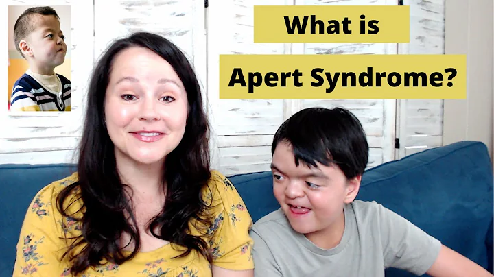 What is Apert Syndrome? James Story | Life with Ap...