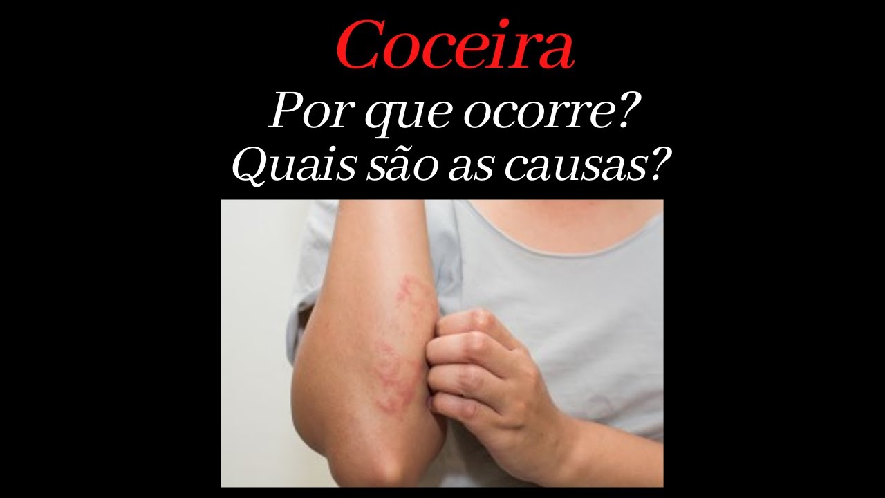 Coceira: por que ocorre? Quais são as causas? - YouTube