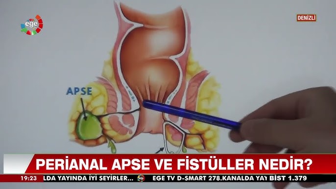 X-nurlari bilan porno rasmlar Katta xotinning uy qurilishi video
